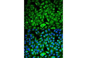 Immunofluorescence analysis of HeLa cells using PEBP1 antibody. (PEBP1 Antikörper)