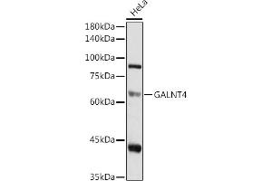 Western blot analysis of extracts of HeLa cells, using G antibody (ABIN6135078, ABIN6140946, ABIN7101653 and ABIN7101654) at 1:1000 dilution. (GALNT4 Antikörper)