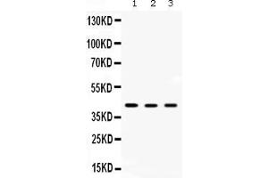 Western blot analysis of AMACR expression in rat kidney extract ( Lane 1), rat liver extract ( Lane 2) and HEPG2 whole cell lysates ( Lane 3). (AMACR Antikörper  (Middle Region))