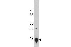 A375 cell lysates probed with GLT (24CT661. (SLC1A2 Antikörper)