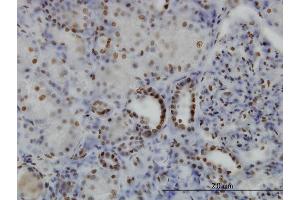 Immunoperoxidase of monoclonal antibody to SGK on formalin-fixed paraffin-embedded human kidney. (SGK1 Antikörper  (AA 1-90))