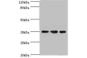 Western blot All lanes: AIMP2 antibody at 5 μg/mL Lane 1: Hela whole cell lysate Lane 2: HepG2 whole cell lysate Lane 3: K562 whole cell lysate Secondary Goat polyclonal to rabbit IgG at 1/10000 dilution Predicted band size: 35 kDa Observed band size: 35 kDa (AIMP2 Antikörper  (AA 141-320))
