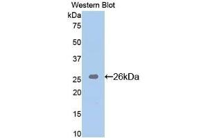 Detection of Recombinant Bid, Mouse using Polyclonal Antibody to BH3 Interacting Domain Death Agonist (Bid) (BID Antikörper  (AA 1-195))