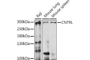 Western blot analysis of extracts of various cell lines, using CNTRL antibody (ABIN7266270) at 1:1000 dilution. (Centriolin Antikörper  (AA 250-500))