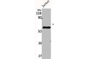 Western Blot analysis of Jurkat cells using CYP2A7 Polyclonal Antibody (CYP2A7 Antikörper  (C-Term))