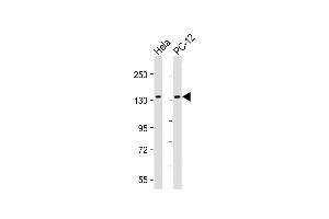 All lanes : Anti-KIF1B Antibody at 1:2000 dilution Lane 1: Hela whole cell lysate Lane 2: PC-12 whole cell lysate Lysates/proteins at 20 μg per lane. (KIF1B Antikörper)