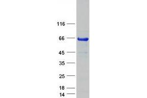Validation with Western Blot