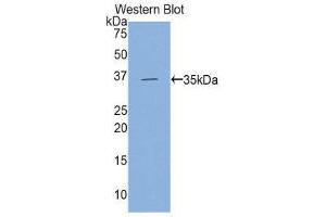 Western Blotting (WB) image for anti-Hexokinase 2 (HK2) (AA 619-917) antibody (ABIN3204500) (Hexokinase 2 Antikörper  (AA 619-917))