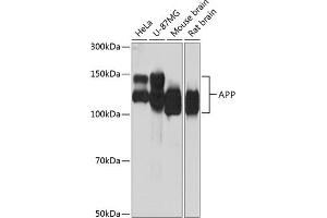 Western blot analysis of extracts of various cell lines, using APP antibody (ABIN7265575) at 1:1000 dilution. (APP Antikörper)