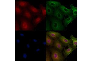 ABIN6260199 and ABIN6266752 staining  cells by IF/ICC. (DMC1 Antikörper  (Internal Region))