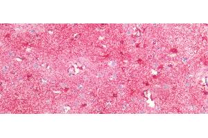Detection of GFAP in Human Brain Tissue using Monoclonal Antibody to Glial Fibrillary Acidic Protein (GFAP) (GFAP Antikörper  (AA 1-430))