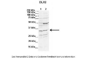 Lanes:  1. (DLX2 Antikörper  (N-Term))