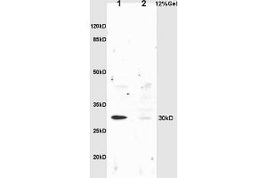 L1 rat liver lysates L2 rat brain lysates probed with Anti NQO1 Polyclonal Antibody, Unconjugated (ABIN678428) at 1:200 overnight at 4 °C. (NQO1 Antikörper  (AA 201-274))