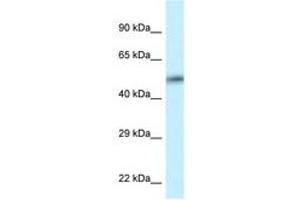Image no. 1 for anti-Calcium/calmodulin-Dependent Protein Kinase II delta (CAMK2D) (AA 302-351) antibody (ABIN6747600) (CAMK2D Antikörper  (AA 302-351))