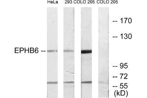 Western blot analysis of extracts from HeLa cells, 293 cells and COLO cells, using EPHB6 antibody.