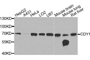 Western blot analysis of extracts of various cell lines, using CDY1 antibody (ABIN6003586) at 1/1000 dilution. (CDY1 Antikörper)