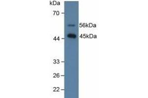 Detection of SPD in Human Lung Tissue using Polyclonal Antibody to Surfactant Associated Protein D (SPD) (SFTPD Antikörper  (AA 21-375))