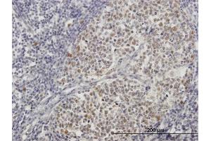 Immunoperoxidase of purified MaxPab antibody to ZNF342 on formalin-fixed paraffin-embedded human lymph node. (Zinc Finger Protein 296 (ZNF296) (AA 1-475) Antikörper)