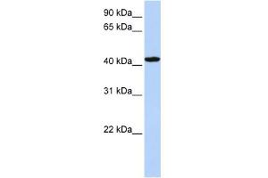 WB Suggested Anti-TADA1L Antibody Titration: 0. (TADA1 Antikörper  (C-Term))
