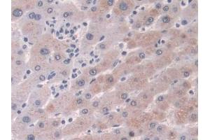 DAB staining on IHC-P; Samples: Human Liver Tissue (CRABP2 Antikörper  (AA 1-138))