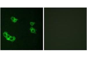 Immunofluorescence analysis of MCF7 cells, using PTHR1 Antibody. (PTH1R Antikörper  (AA 145-194))