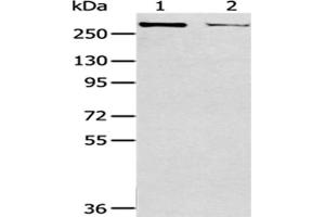 Gel: 6 % SDS-PAGE,Lysate: 40 μg,Lane 1-2: MCF7 cells, Hela cells,Primary antibody: ABIN7193051(WNK2 Antibody) at dilution 1/200 dilution,Secondary antibody: Goat anti rabbit IgG at 1/8000 dilution,Exposure time: 10 minutes (WNK2 Antikörper)