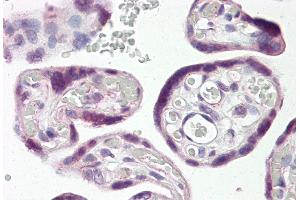 Placenta (DLX3 Antikörper  (N-Term))