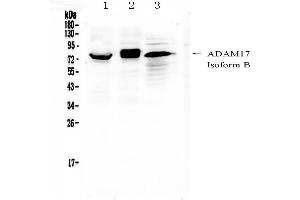 Western blot analysis of ADAM17 using anti-ADAM17 antibody . (ADAM17 Antikörper  (AA 215-433))