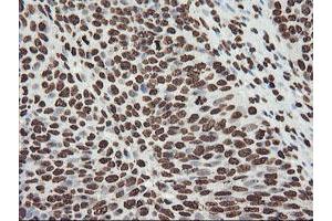 Image no. 10 for anti-F-Box Protein 21 (FBXO21) antibody (ABIN1498233) (FBXO21 Antikörper)