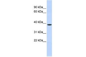 WB Suggested Anti-ZFPL1 Antibody Titration: 0. (ZFPL1 Antikörper  (Middle Region))
