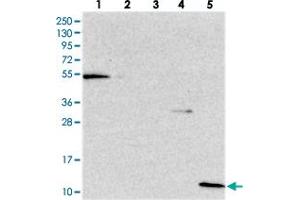 Western blot analysis of Lane 1: RT-4, Lane 2: U-251 MG, Lane 3: Human Plasma, Lane 4: Liver, Lane 5: Tonsil with CRIP1 polyclonal antibody .