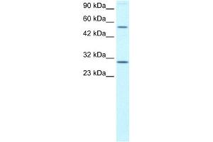 WB Suggested Anti-OSR2 Antibody Titration: 0. (OSR2 Antikörper  (N-Term))