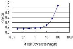 Sandwich ELISA detection sensitivity ranging from 3 ng/mL to 100 ng/mL. (SULT1E1 (Human) Matched Antibody Pair)