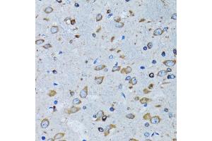 Immunohistochemistry of paraffin-embedded mouse brain using RARS antibody (ABIN5973728) at dilution of 1/100 (40x lens). (RARS Antikörper)