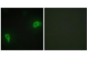 Immunofluorescence analysis of HepG2 cells, using DOK7 antibody. (DOK7 Antikörper  (N-Term))