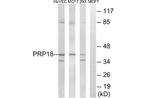 Western blot analysis of extracts from HuvEc cells, MCF-7 cells and 293 cells, using PRPF18 antibody. (PRPF18 Antikörper  (Internal Region))