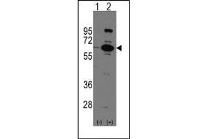Image no. 1 for anti-Poly (ADP-Ribose) Polymerase Family, Member 6 (PARP6) (C-Term) antibody (ABIN358805) (PARP6 Antikörper  (C-Term))