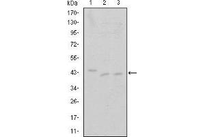 Western blot analysis using CDK9 mouse mAb against Jurkat (1), A431 (2) and HEK293 (3) cell lysate.