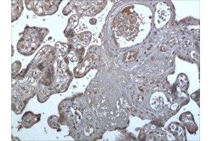 Immunohistochemistry (IHC) image for anti-Triggering Receptor Expressed On Myeloid Cells 1 (TREM1) (AA 21-205) antibody (ABIN1983467) (TREM1 Antikörper  (AA 21-205))