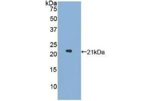 Detection of Recombinant GaA, Human using Polyclonal Antibody to Glucosidase Alpha, Acid (GaA) (GAA Antikörper  (AA 595-770))