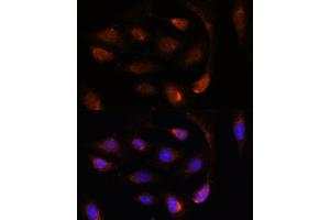 Immunofluorescence analysis of U-2 OS cells using SH3BGRL antibody (ABIN7270277) at dilution of 1:100. (SH3BGRL Antikörper  (AA 1-114))