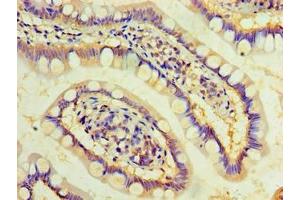 Immunohistochemistry of paraffin-embedded human small intestine tissue using ABIN7149484 at dilution of 1:100