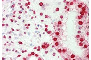 Rabbit Anti-SMARCE1 antibody Catalog Number: ARP33313 Formalin Fixed Paraffin Embedded Tissue: Human Kidney Primary antibody Concentration: 1:100 Secondary Antibody: Donkey anti-Rabbit-Cy3 Secondary Antibody Concentration: 1:200 Magnification: 20x Exposure Time: 0. (SMARCE1 Antikörper  (N-Term))