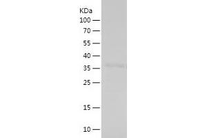 Western Blotting (WB) image for Histone Cluster 1, H1c (HIST1H1C) (AA 28-130) protein (His-IF2DI Tag) (ABIN7282330) (HIST1H1C Protein (AA 28-130) (His-IF2DI Tag))