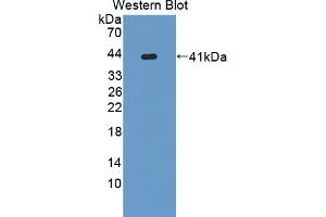 Detection of Recombinant KRT6C, Human using Polyclonal Antibody to Keratin 6C (KRT6C) (Keratin 6C Antikörper  (AA 163-482))