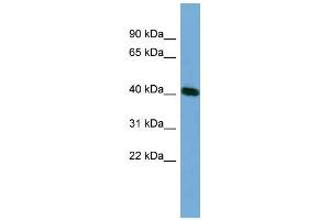 WB Suggested Anti-TSSK2 Antibody Titration: 0. (TSSK2 Antikörper  (Middle Region))