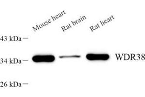 Western blot analysis of WDR38 (ABIN7076218) at dilution of 1: 2000 (WDR38 Antikörper)