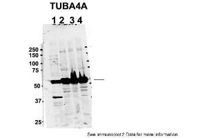 Sample Type: 1. (TUBA4A Antikörper  (Middle Region))