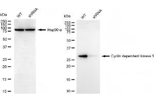 Western blotting analysis using cyclin dependent kinase 5 antibody (ABIN7798216). (CDK5 Antikörper)