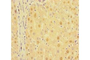 Immunohistochemistry of paraffin-embedded human liver tissue using ABIN7154596 at dilution of 1:100 (RIT1 Antikörper  (AA 1-219))